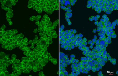 Anti-PLCG2 antibody [HL6425] used in Immunocytochemistry/ Immunofluorescence (ICC/IF). GTX648870